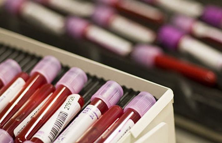 Cum sa te pregatesti pentru recoltarea analizelor de sange