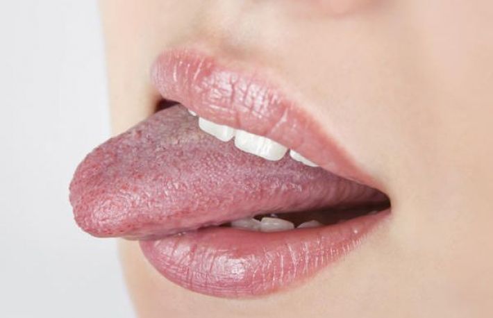 Cum se trateaza muscaturile de limba