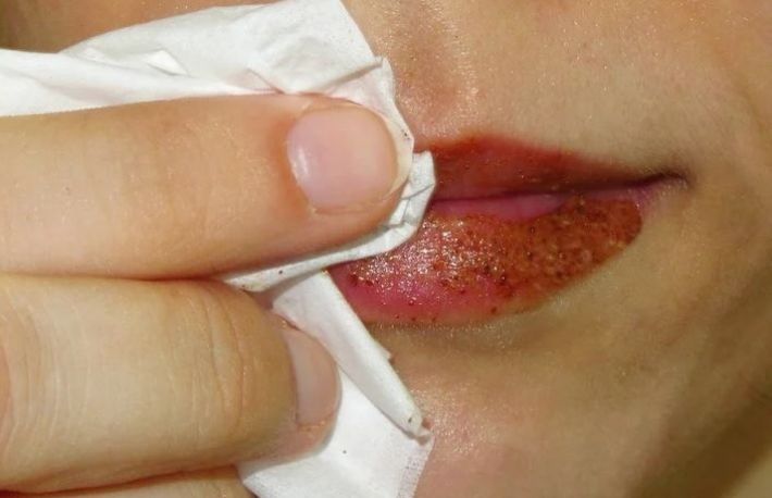 Cum sa iti maresti buzele fara interventie chirurgicala