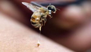Remedii naturiste pentru intepaturile de albina sau de viespe