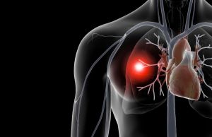Ce este embolismul pulmonar si cum il previi